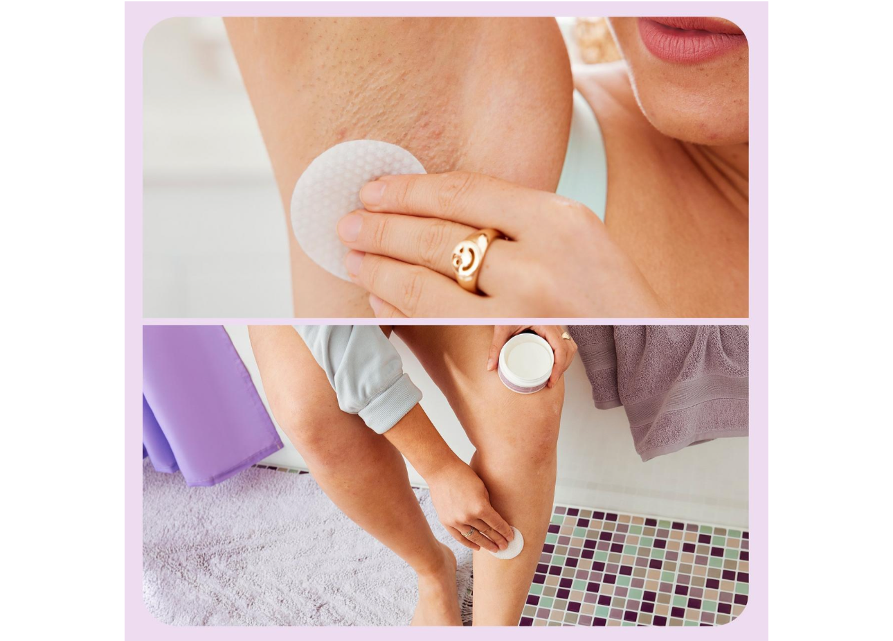 First Aid- Bye Bye Bumps Body Set