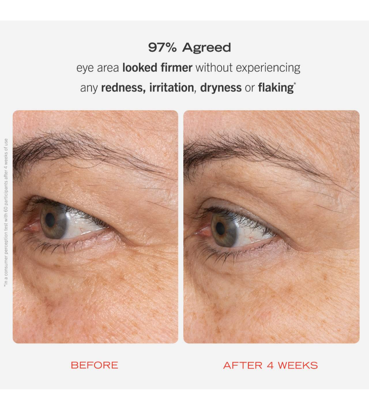 First Aid Beauty- Retinol Eye Cream