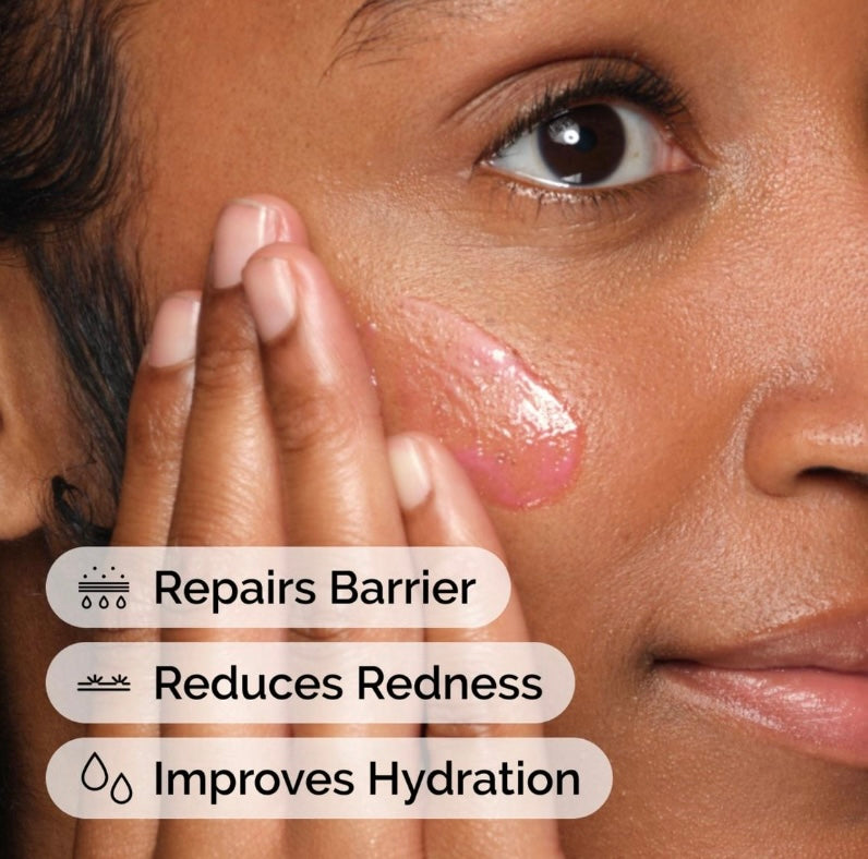 The Ordinary- Soothing & Barrier Support Serum