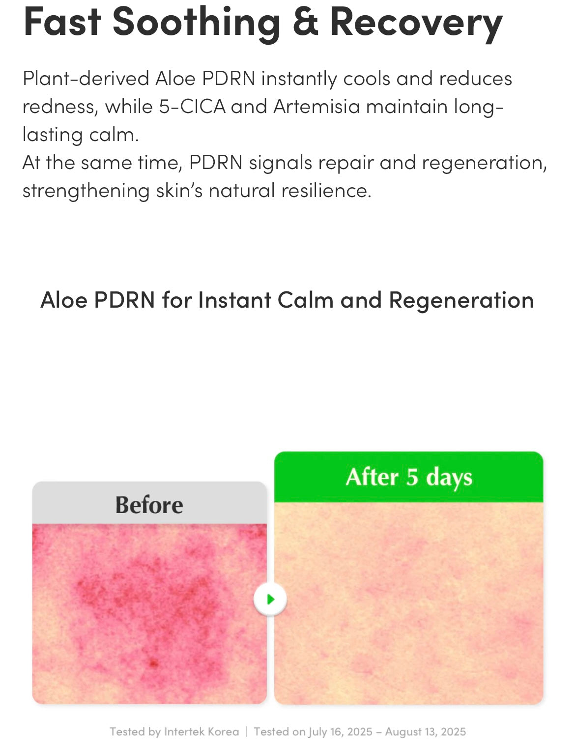 EQQUALBERRY- Aloe PDRN Calming Serum