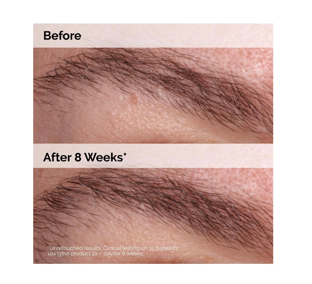 The Ordinary- Multi-peptide Lash and Brow Serum
