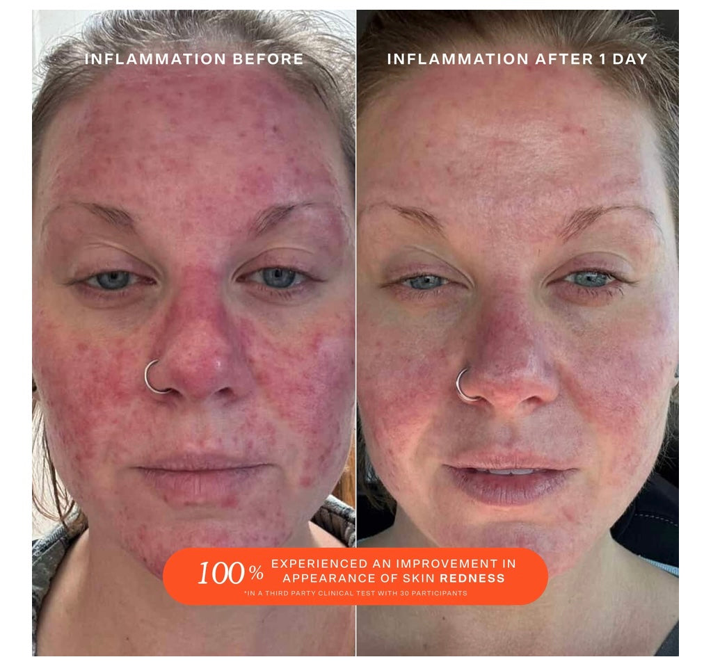 Tower 28- SOS Daily Rescue Facial Spray