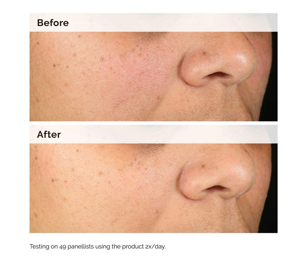 The Ordinary- Alpha Arbutin 2% + HA Hyperpigmentation Serum