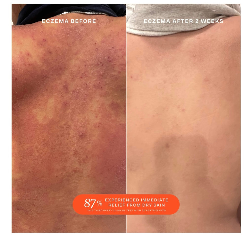 Tower 28- SOS Daily Rescue Facial Spray