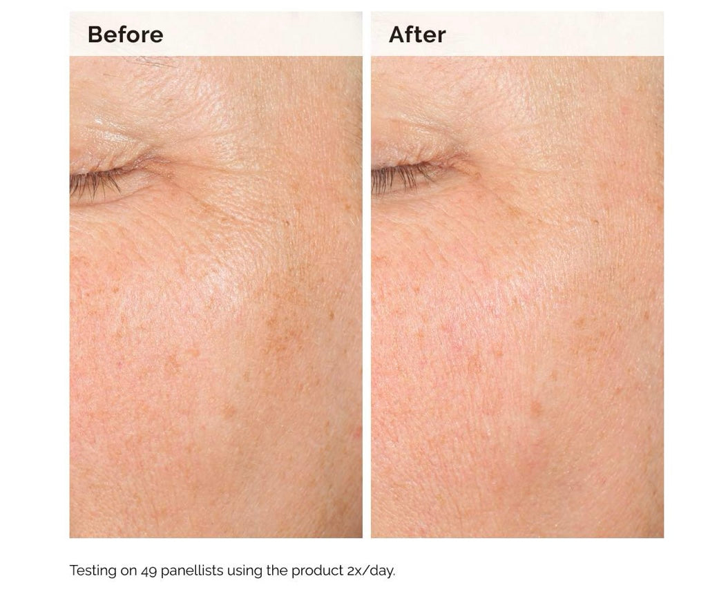 The Ordinary- Alpha Arbutin 2% + HA Hyperpigmentation Serum