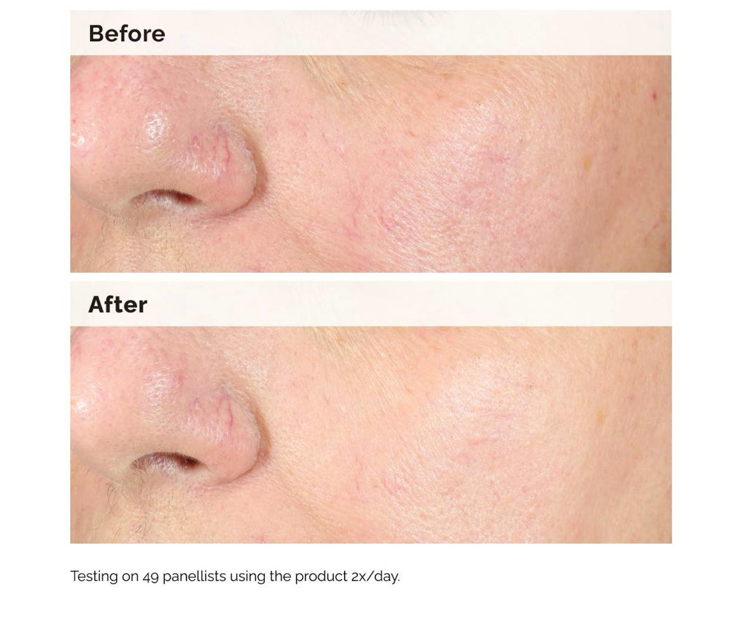 The Ordinary- Alpha Arbutin 2% + HA Hyperpigmentation Serum