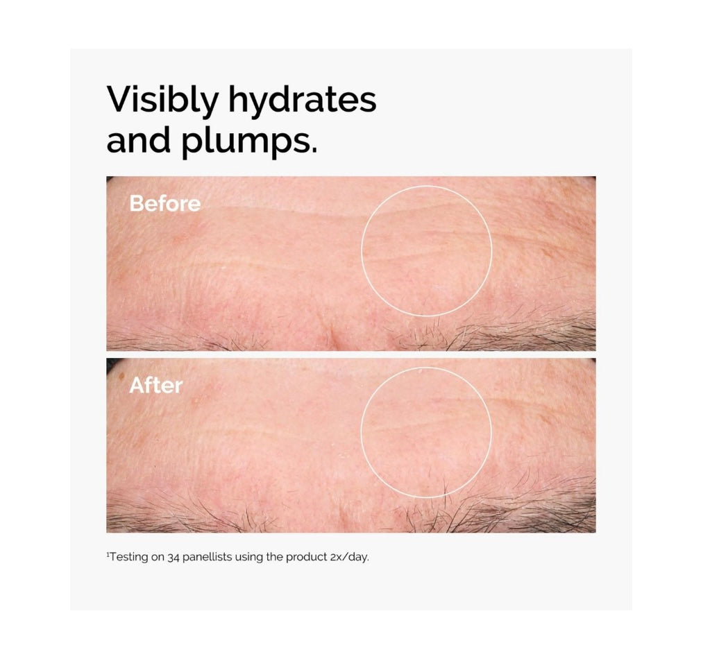 The Ordinary- Hyaluronic Acid 2% + B5 Hydrating Serum