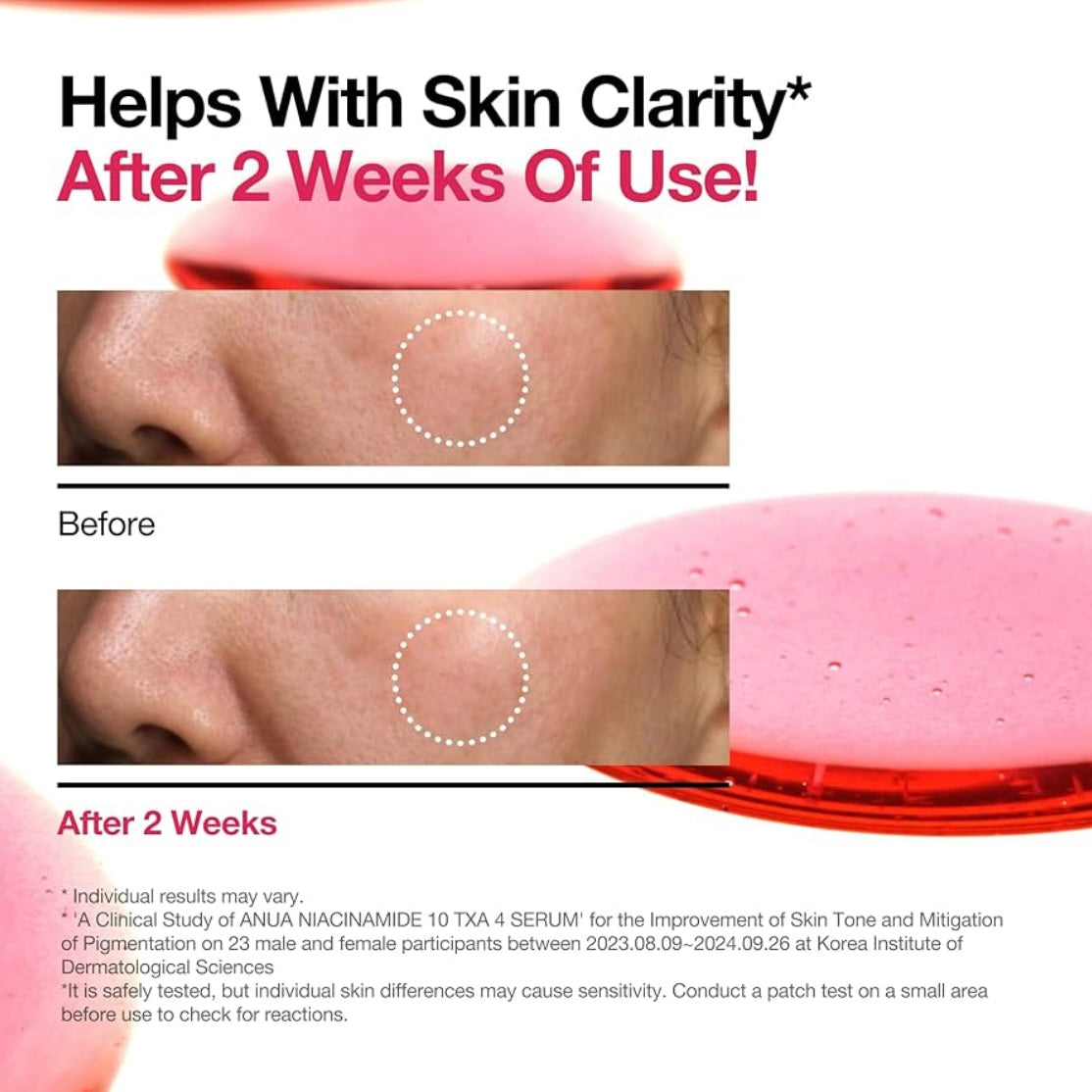 Anua- Niacinamide 10 + TXA 4 Serum