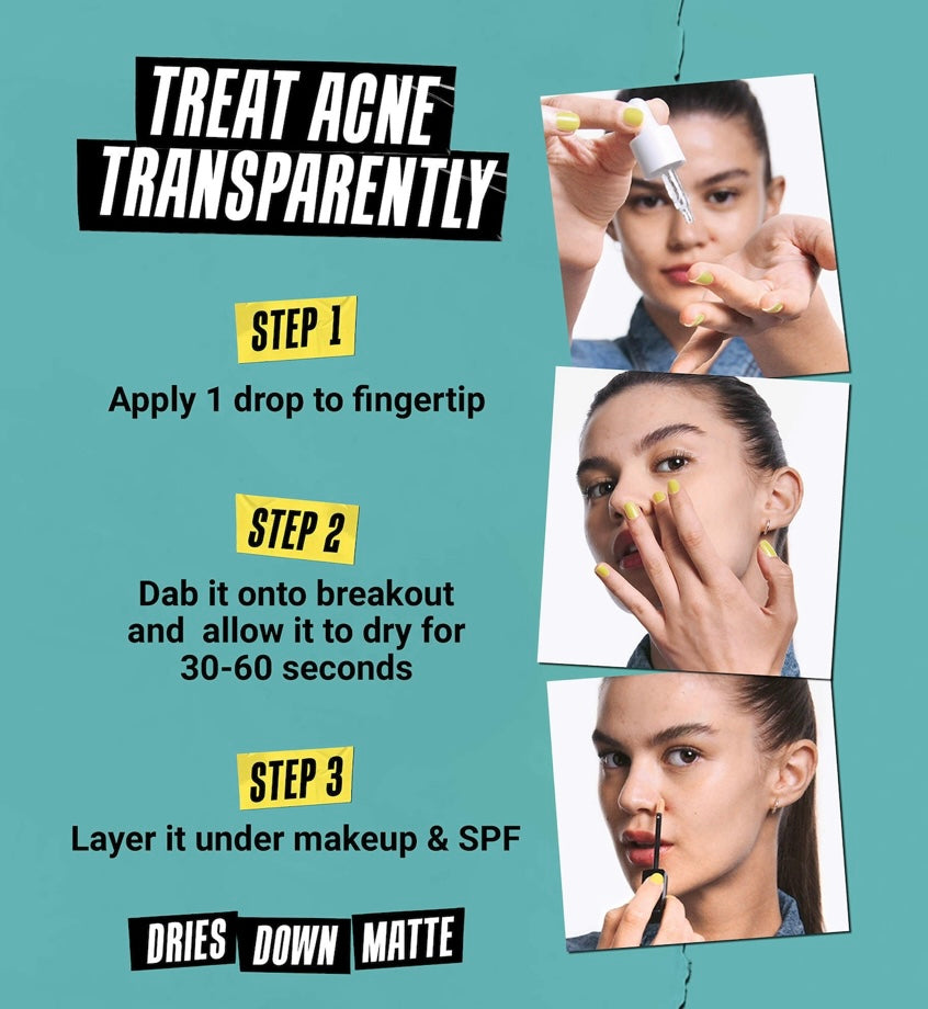 Kiehl’s- Truly Targeted Acne-Clearing Liquid Pimple Patch with Salicylic Acid
