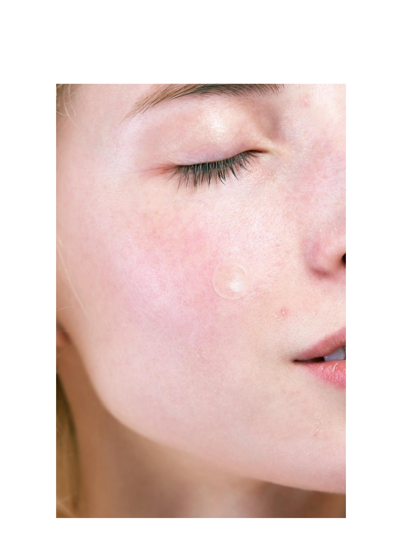 Mighty Patch Acne Pimple Patches