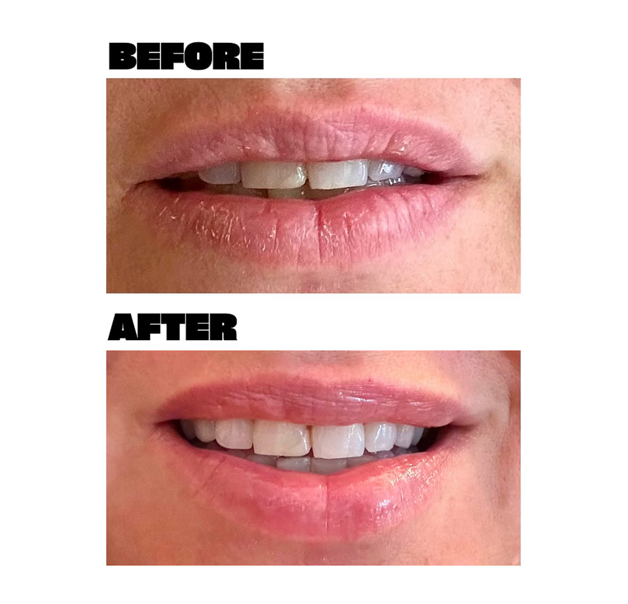 Babe Original Lip Mask