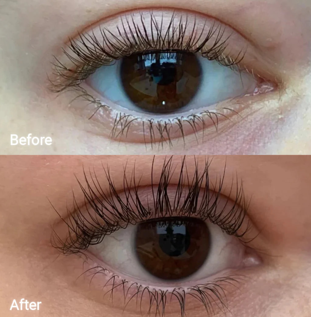FORCHICS - Eyelash Growth Serum