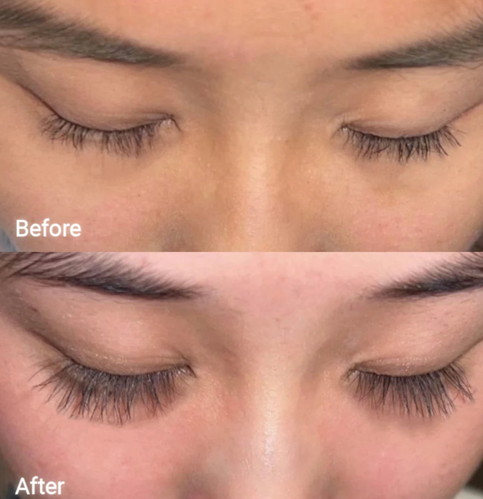 FORCHICS - Eyelash Growth Serum