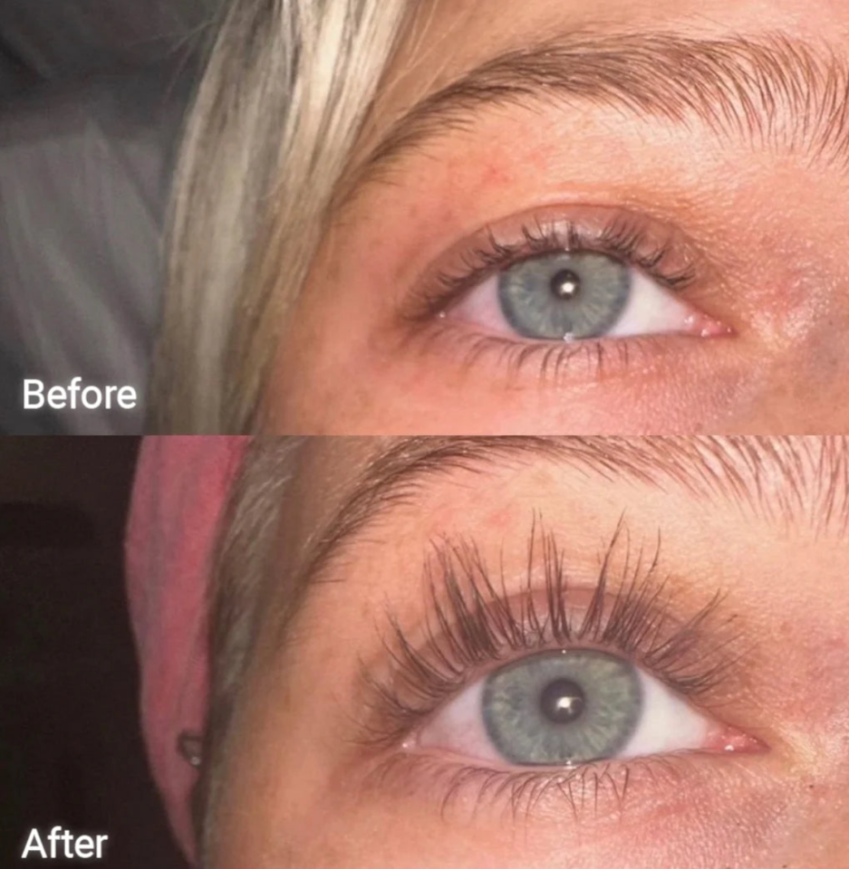 FORCHICS - Eyelash Growth Serum