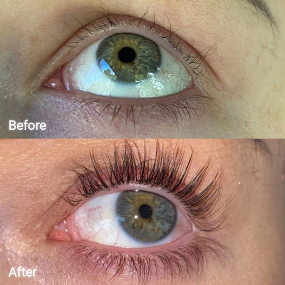 FORCHICS - Eyelash Growth Serum
