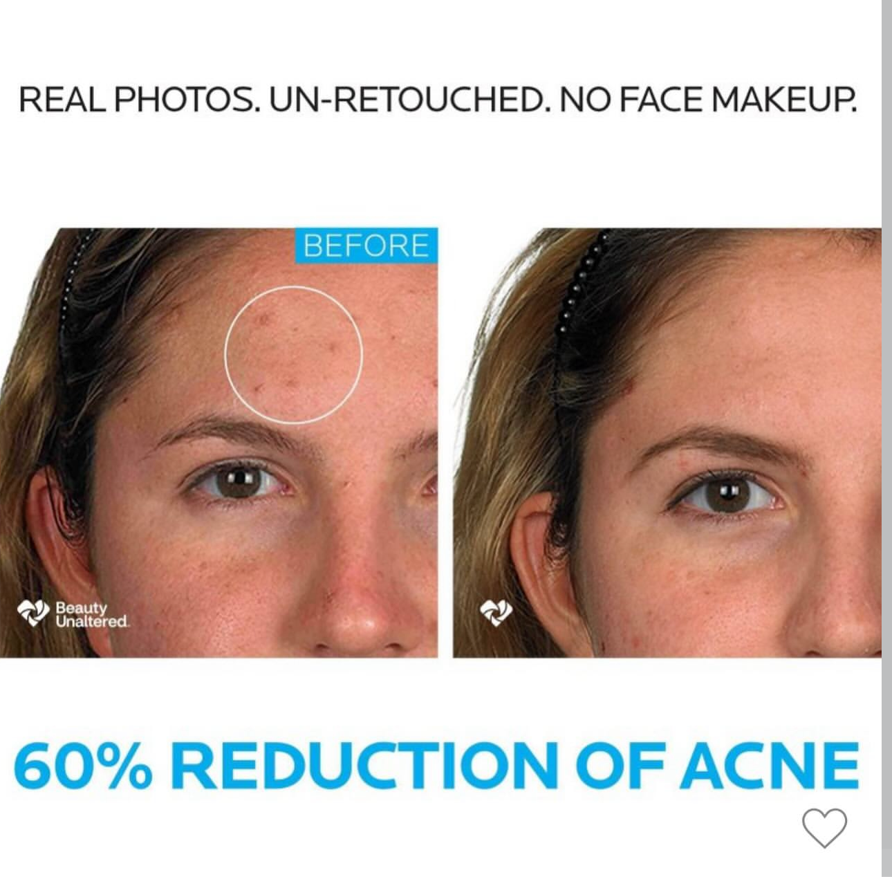 LA ROCHE POSAY-EFFACLAR
DERMATOLOGICAL ACNE SYSTEM