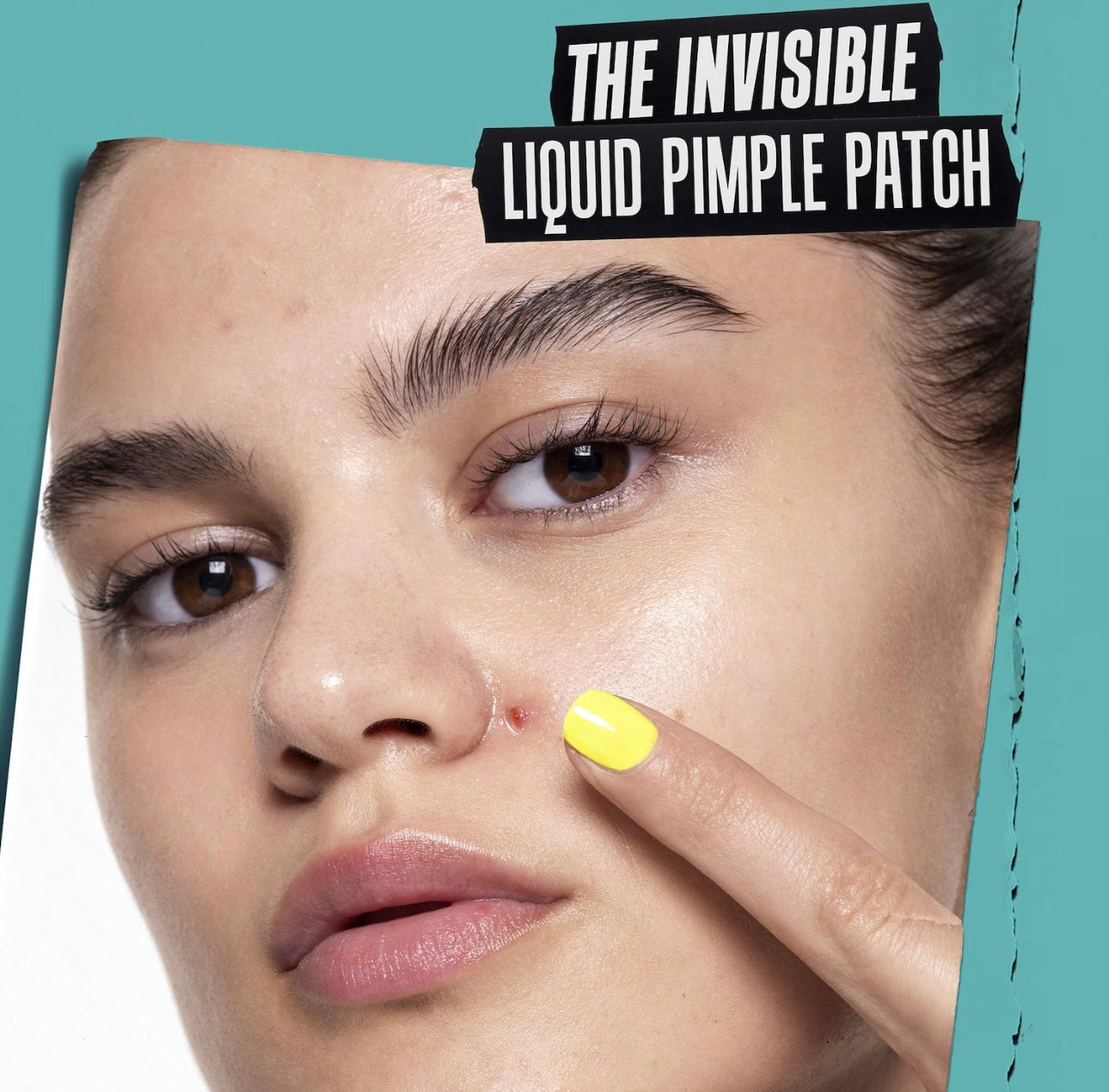 Kiehl’s- Truly Targeted Acne-Clearing Liquid Pimple Patch with Salicylic Acid