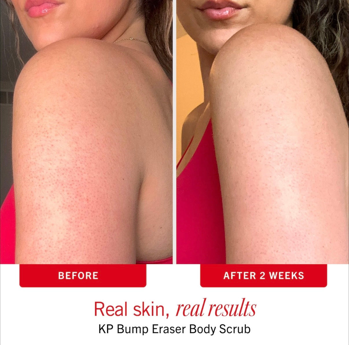 FIRST AID BEAUTY- Smooth Skin Body Bestsellers Body Care Duo with KP Scrub