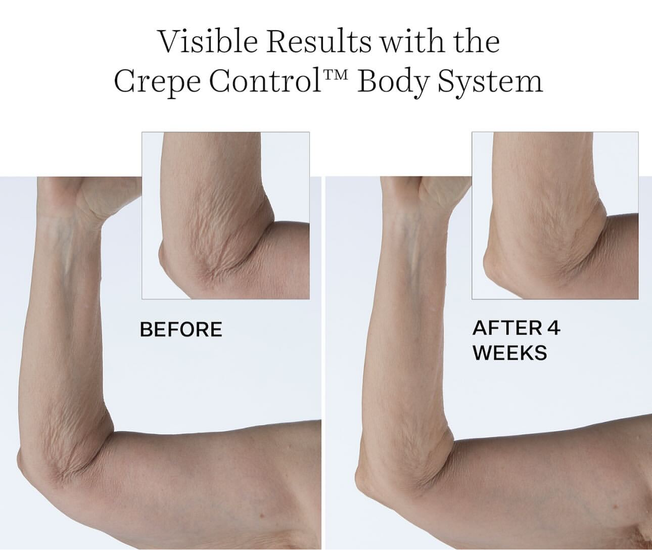 StriVectin- Crepe Control Tightening Body Cream