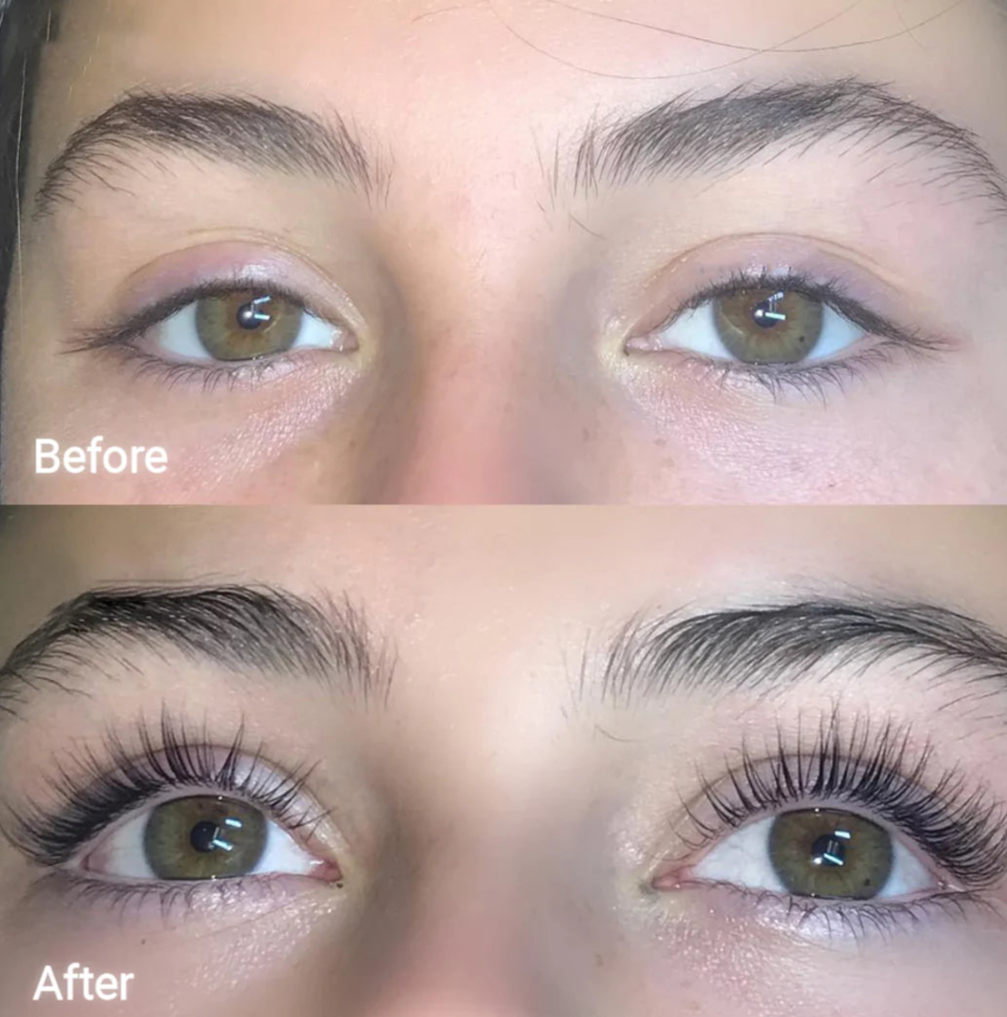 FORCHICS - Eyelash Growth Serum