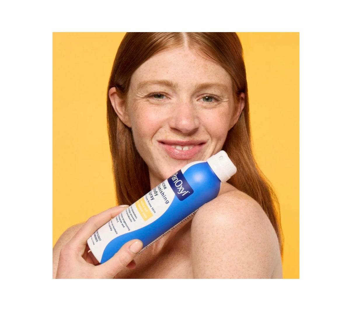 PanOxyl- Acne Banishing Body Spray