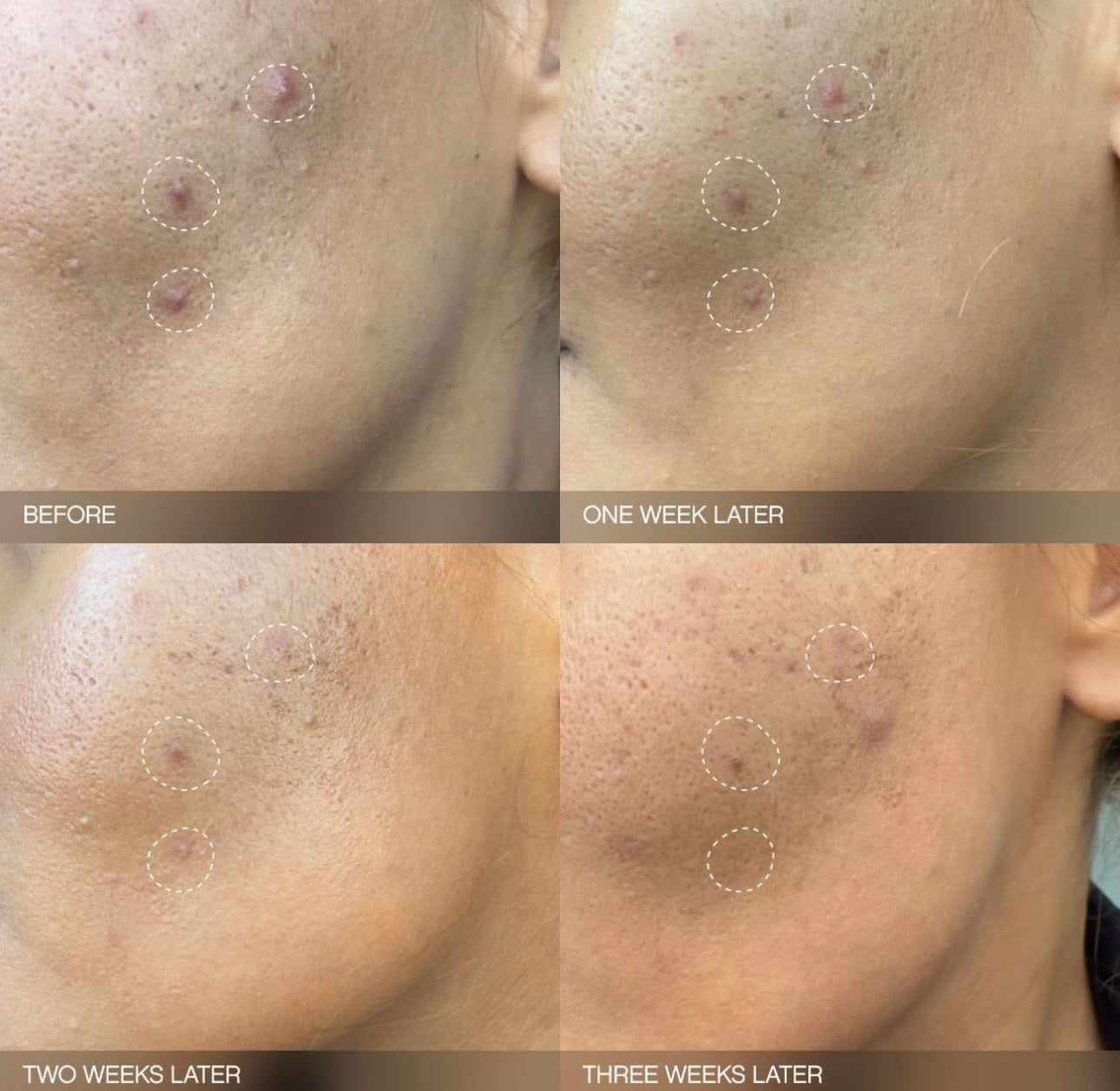 TOPICALS- Faded Brightening Bundle for Discoloration on Face & Body