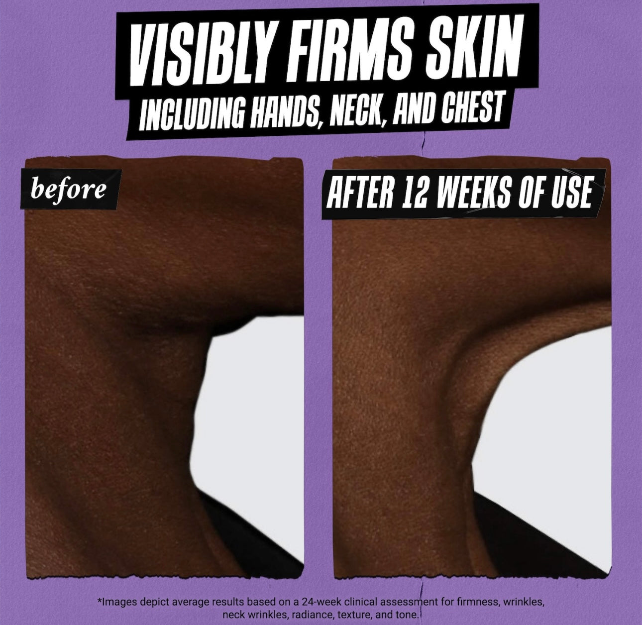 Kiehl’s- Micro-Dose Retinol Serum with Ceramides & Peptide