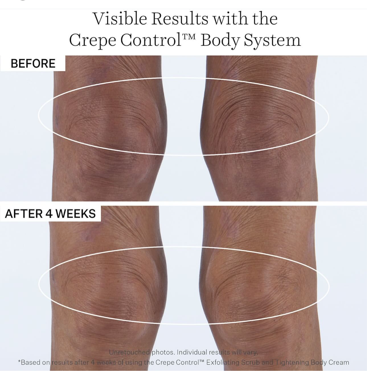 StriVectin- Crepe Control Tightening Body Cream