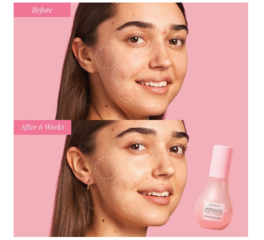 Glow Recipe- Watermelon Glow Niacinamide Dew Drops Serum