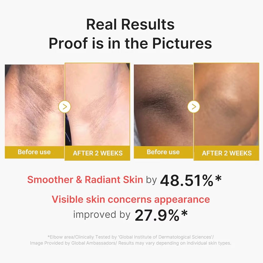 Medicube- Body Peel Shot with Kojic Acid and Tumeric