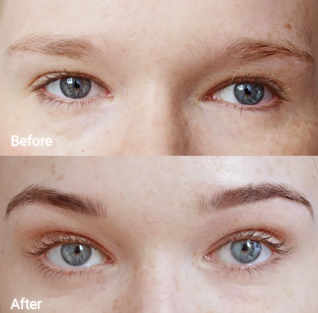 FORCHICS- Eyebrow Growth Serum