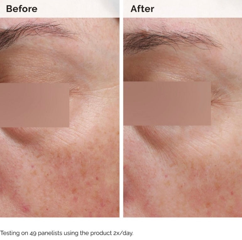 The Ordinary- Body Care