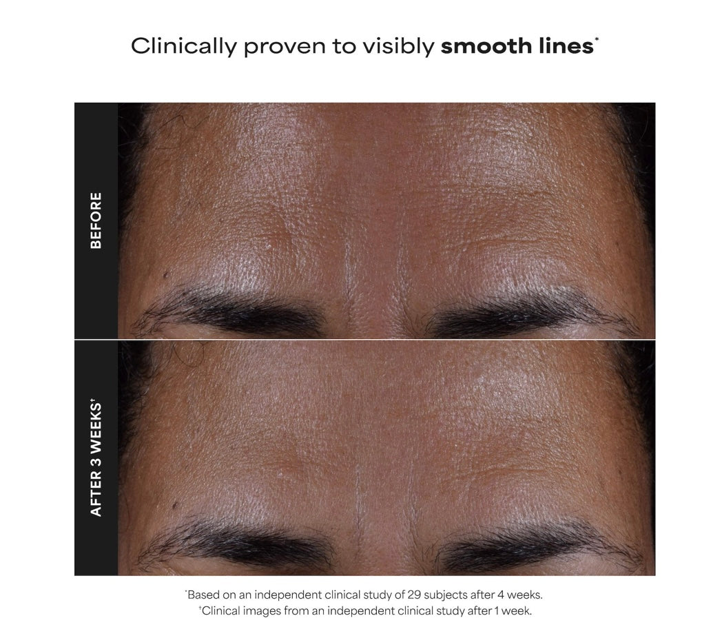 PAULA’S CHOICE- Skin Perfecting 2% BHA Exfoliating Toner for Clear Skin
