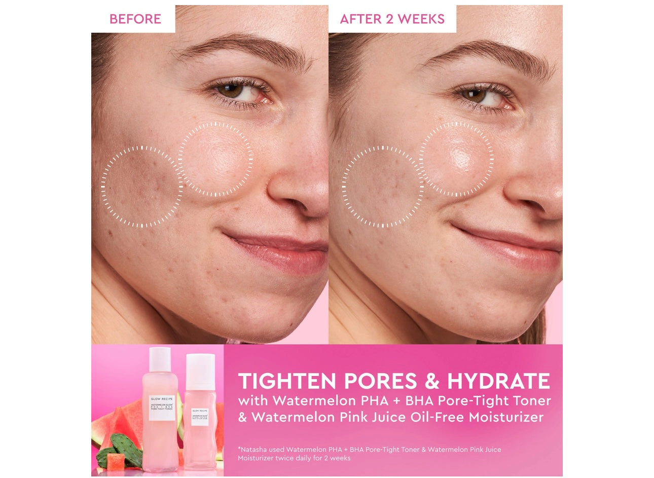 GLOW RECIPE- Watermelon Pink Juice Oil-Free Moisturizer