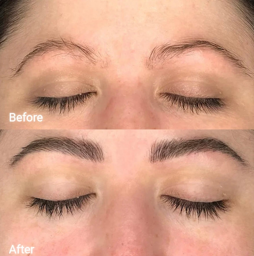 FORCHICS- Eyebrow Growth Serum