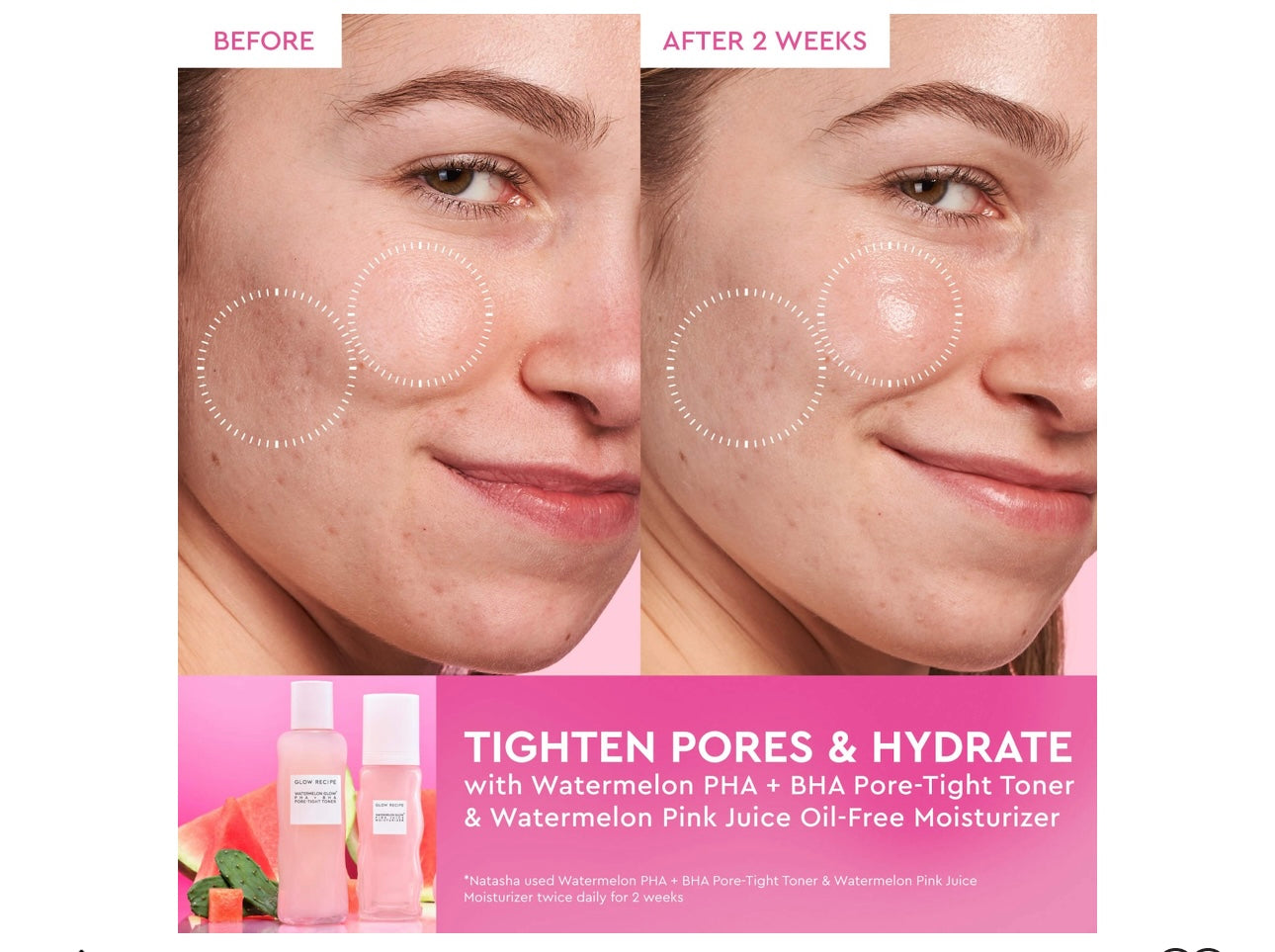GLOW RECIPE- Mini Watermelon Glow PHA + BHA Pore-Tight Toner