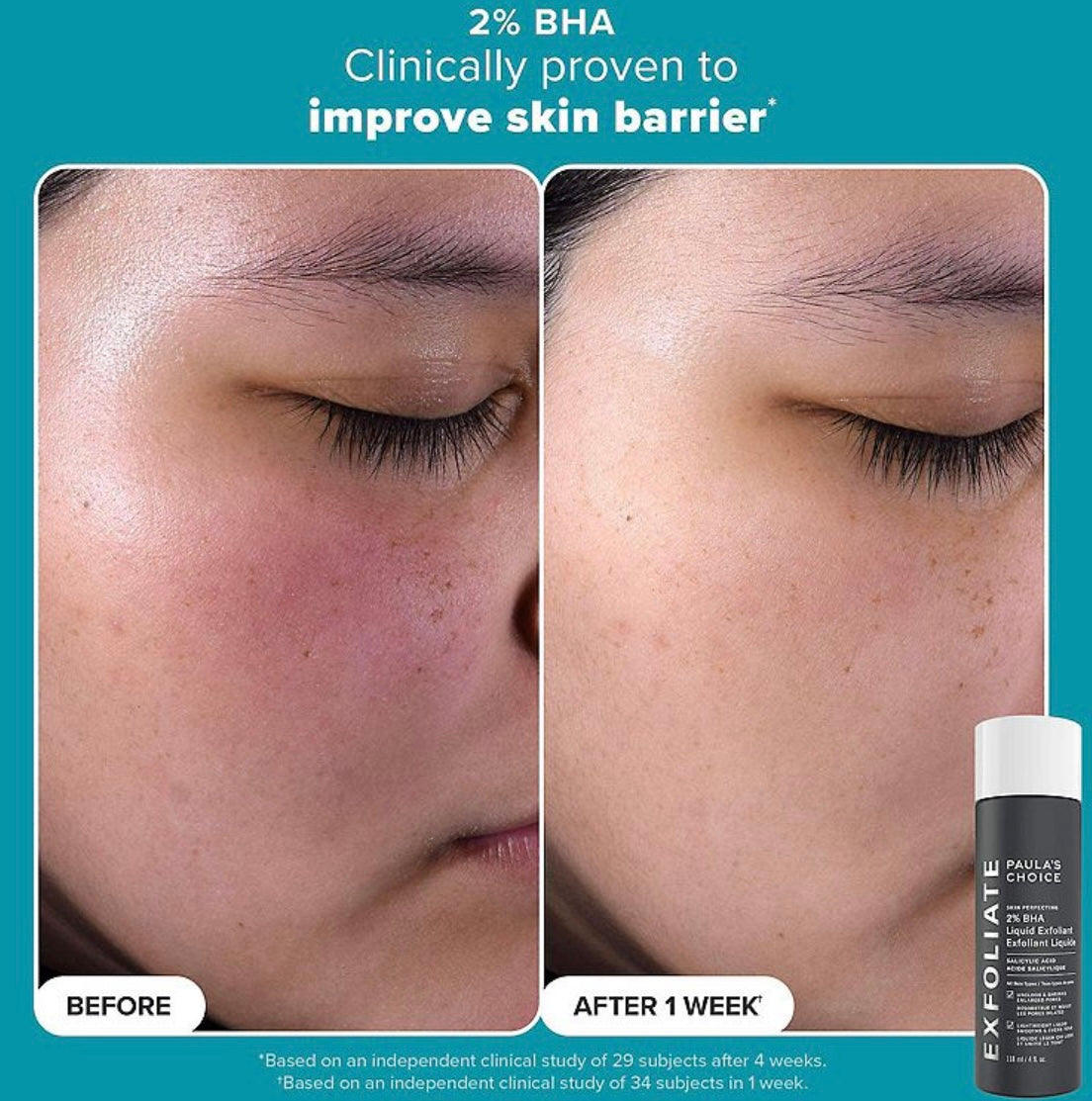 Paula’s Choice- Smooth & Glow Set for Clearer, Brighter Skin