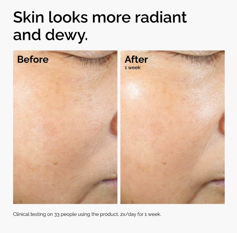 The Ordinary- Rice Lipids+Ectoin Microemulsion Moisturizer
