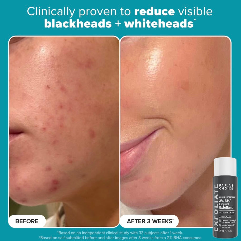 Paula’s Choice- Mini Exfoliation Icons Kit for clear, brighter looking skin