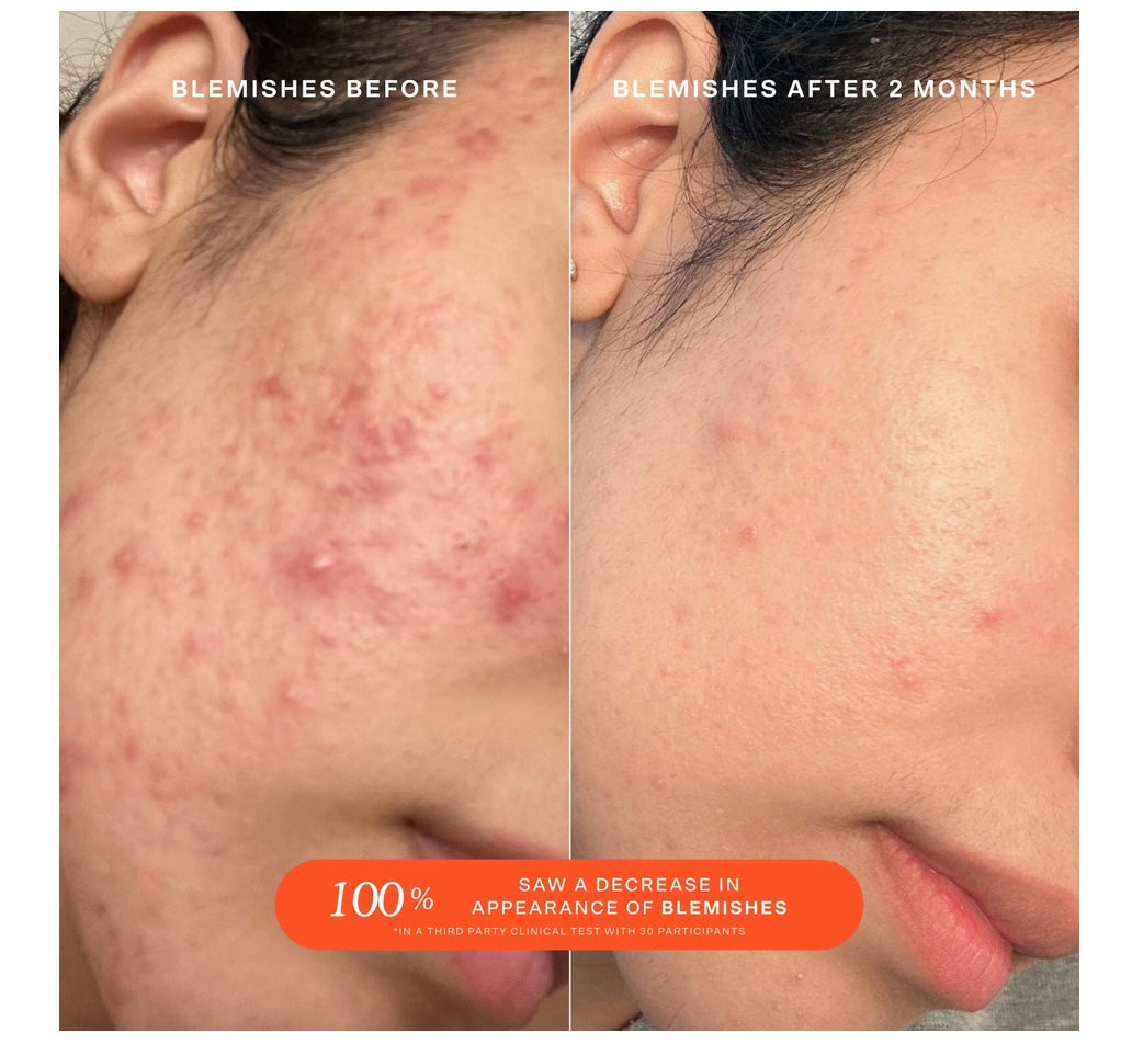 Tower 28- SOS Daily Rescue Facial Spray