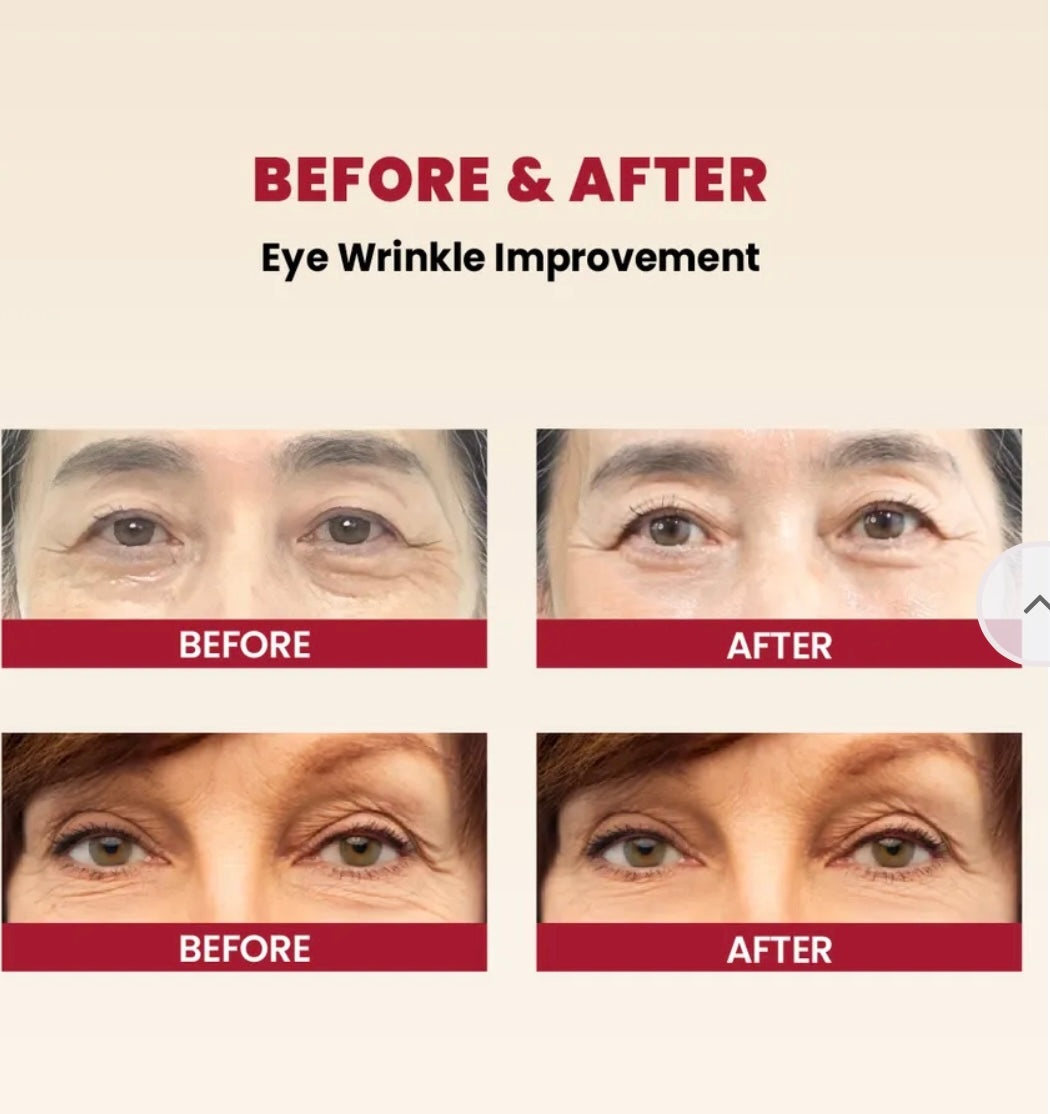 K-Secret Seoul 1988 Eye Cream: Retinal Liposome 4% + Fermented Bean