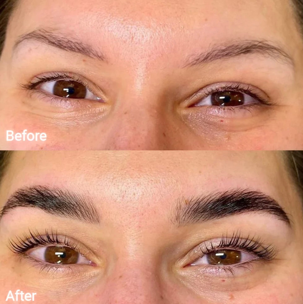 FORCHICS- Eyebrow Growth Serum