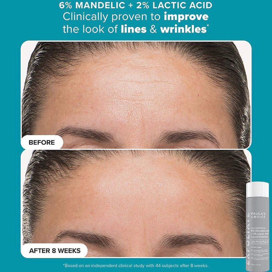 Paula’s Choice- Smooth & Glow Set for Clearer, Brighter Skin