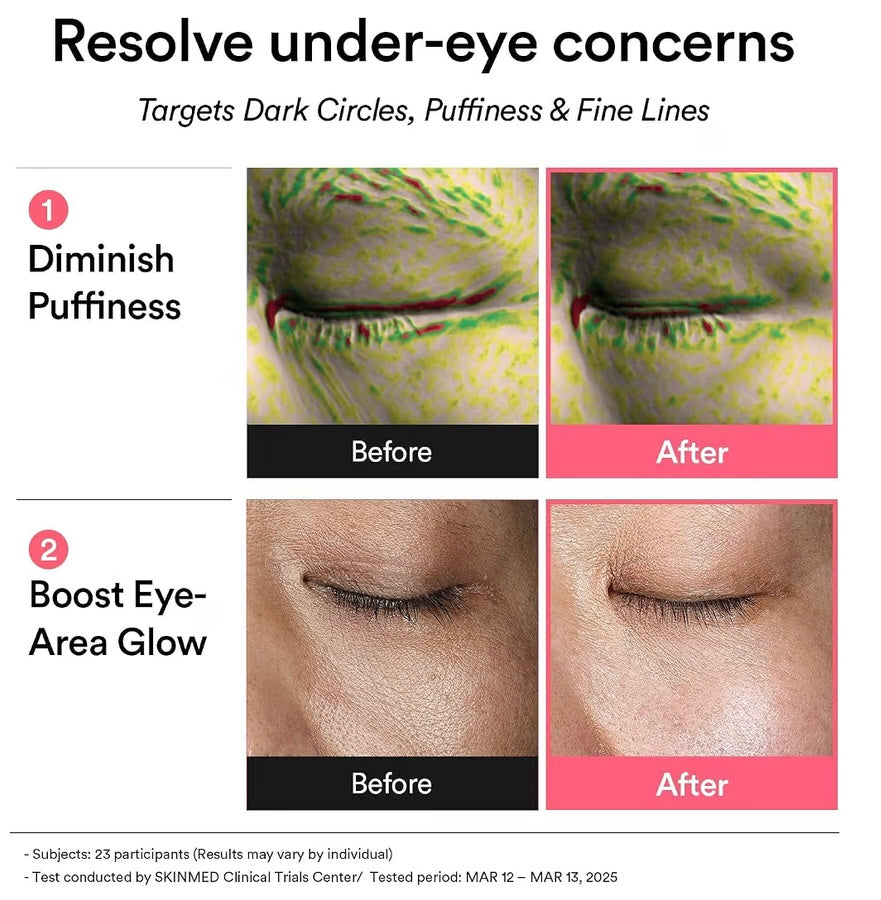 Abib- PDRN Retinal Eye Patches Glow Jelly