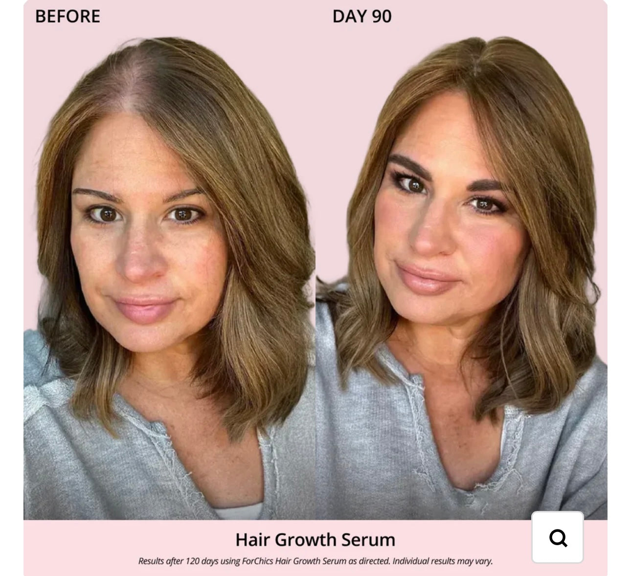 FORCHICS- Hair Growth Oil Spray