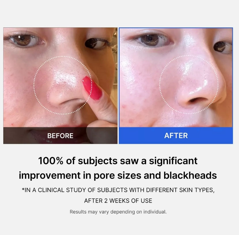 Medicube- Zero Pore Pad