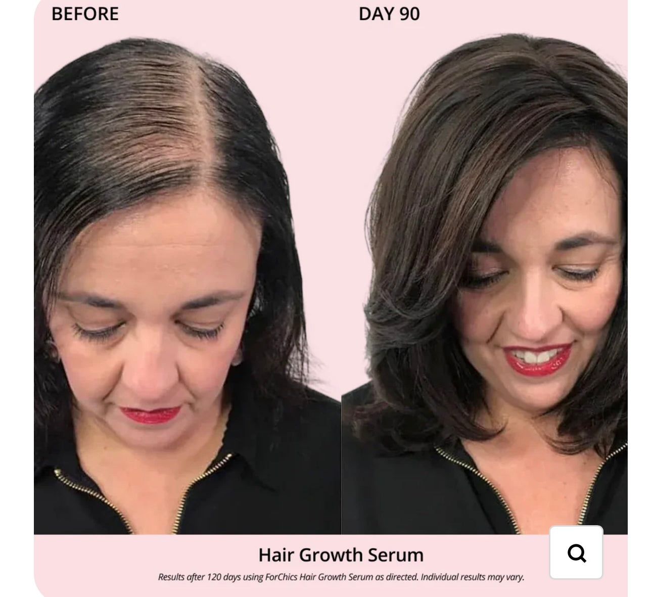 FORCHICS- Hair Growth Oil Spray