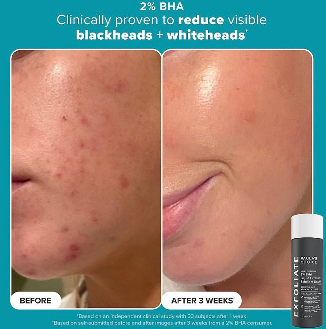 Paula’s Choice- Smooth & Glow Set for Clearer, Brighter Skin