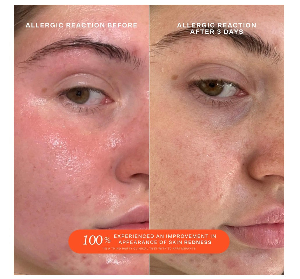 Tower 28- SOS Daily Rescue Facial Spray