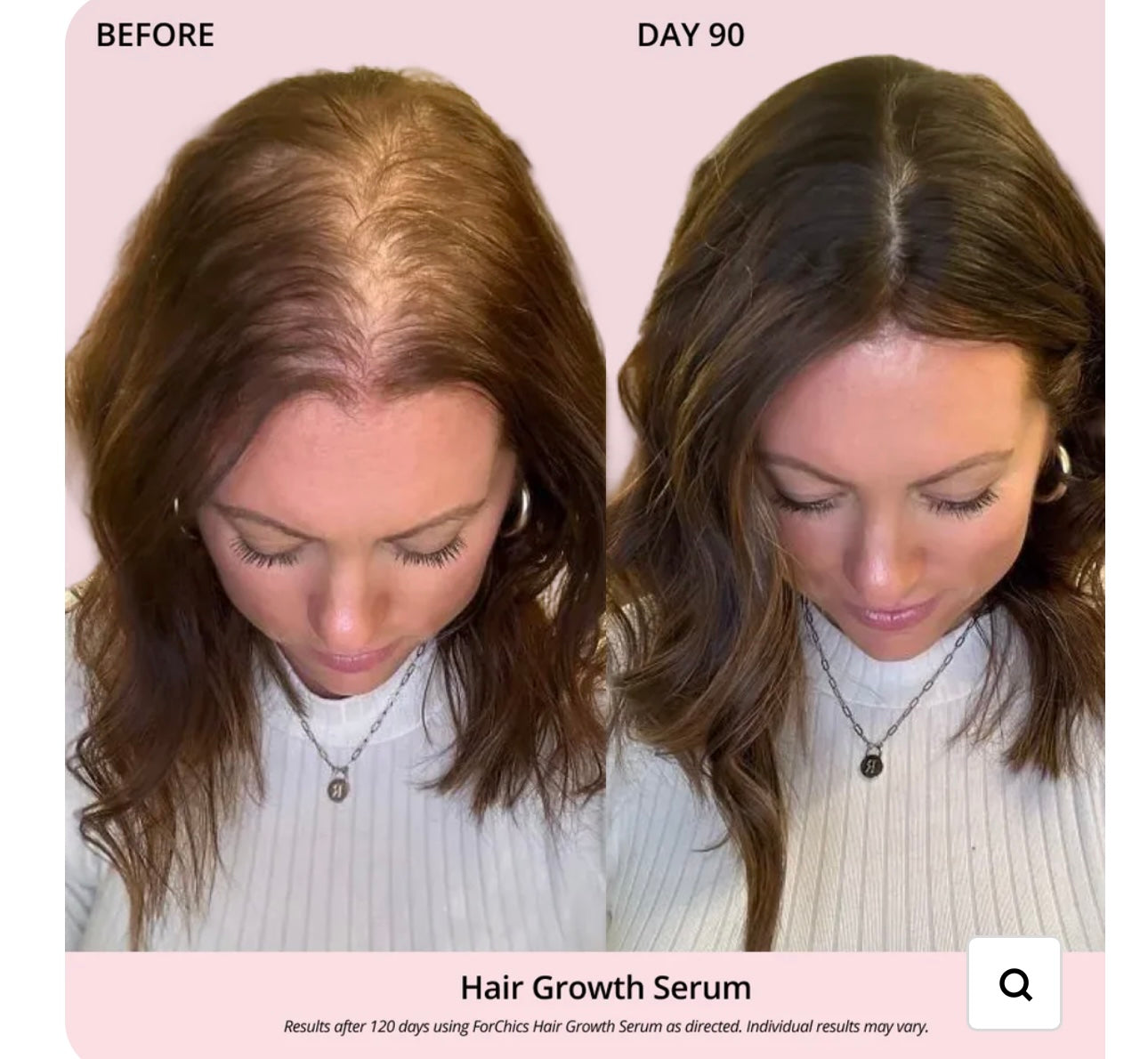 FORCHICS- Hair Growth Oil Spray